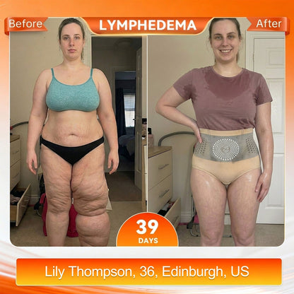 🎉 Congratulations! You're our 500th customer today! Add a 2nd Pair of ALLYBEE® Thermogenic Fat-Burning Sculpting Shorts for 80% OFF and enjoy uninterrupted 30-minute daily body sculpting for a firmer, smoother-looking silhouette! ✨