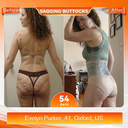 🎉 Congratulations! You're our 500th customer today! Add a 2nd Pair of ALLYBEE® Thermogenic Fat-Burning Sculpting Shorts for 80% OFF and enjoy uninterrupted 30-minute daily body sculpting for a firmer, smoother-looking silhouette! ✨