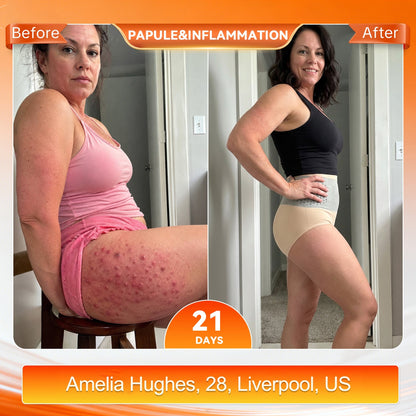 🎉 Congratulations! You're our 500th customer today! Add a 2nd Pair of ALLYBEE® Thermogenic Fat-Burning Sculpting Shorts for 80% OFF and enjoy uninterrupted 30-minute daily body sculpting for a firmer, smoother-looking silhouette! ✨