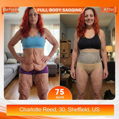 🎉 Congratulations! You're our 500th customer today! Add a 2nd Pair of ALLYBEE® Thermogenic Fat-Burning Sculpting Shorts for 80% OFF and enjoy uninterrupted 30-minute daily body sculpting for a firmer, smoother-looking silhouette! ✨