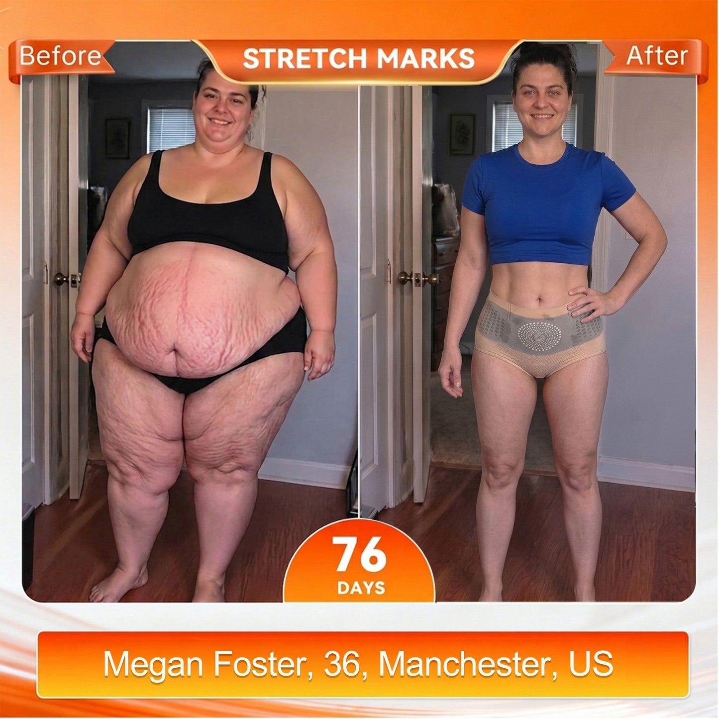 🎉 Congratulations! You're our 500th customer today! Add a 2nd Pair of ALLYBEE® Thermogenic Fat-Burning Sculpting Shorts for 80% OFF and enjoy uninterrupted 30-minute daily body sculpting for a firmer, smoother-looking silhouette! ✨